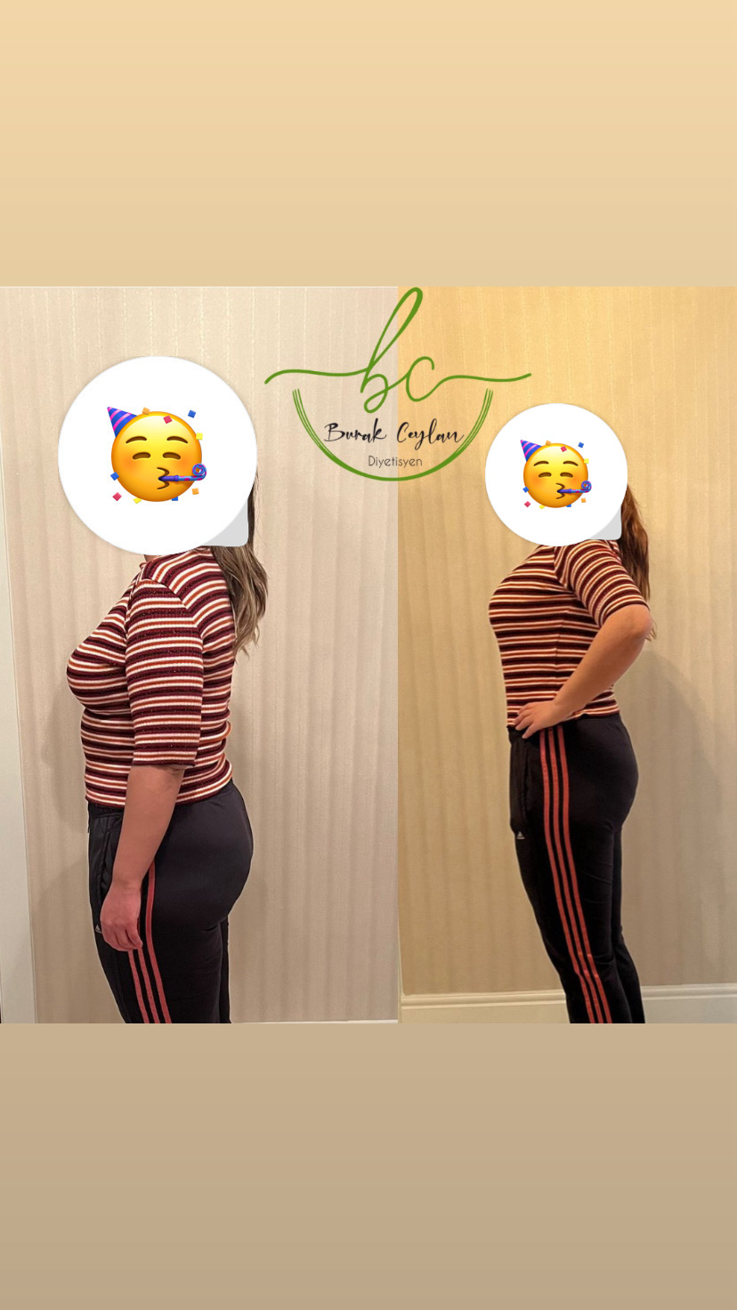 Dönüşüm Hikayesi - Hale Ç.