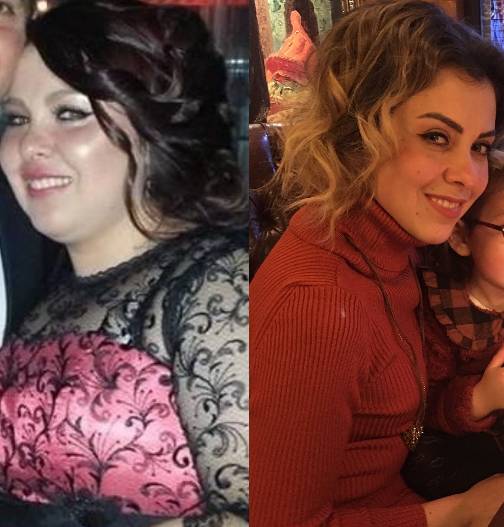 Dönüşüm Hikayesi - Elif K.